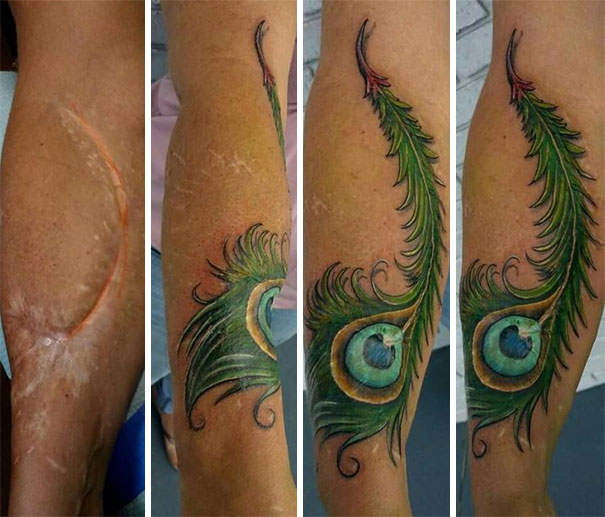 211 Amazing Tattoos That Turn Scars Into Works Of Art Bored Panda